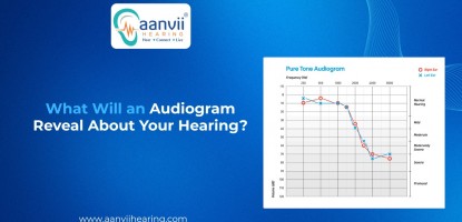 What Will an Audiogram Reveal About Your Hearing?