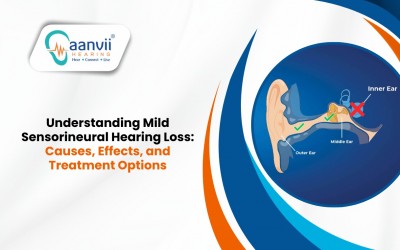 Understanding Mild Sensorineural Hearing Loss: Causes, Effects, and Treatment Options