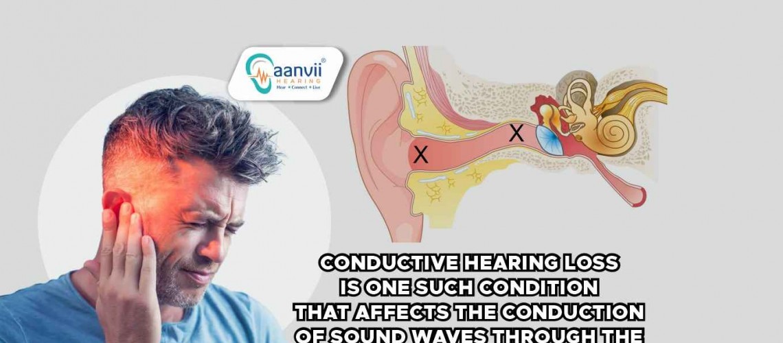 Understanding Conductive Hearing Loss: Causes and Characteristics