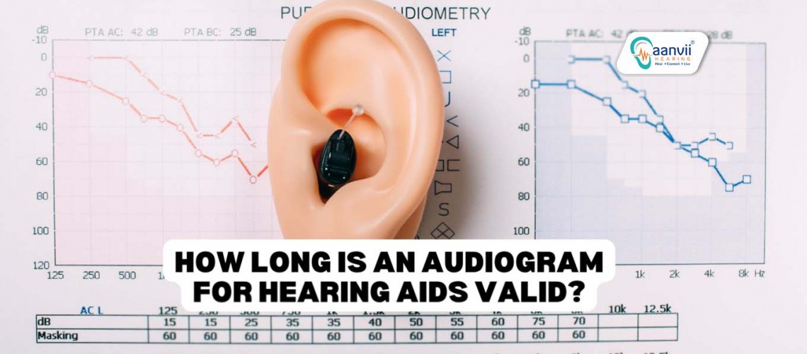 How Long Is An Audiogram or Prescription For Hearing Aids Valid? How Long Is An Audiogram or Prescription For Hearing Aids Valid?