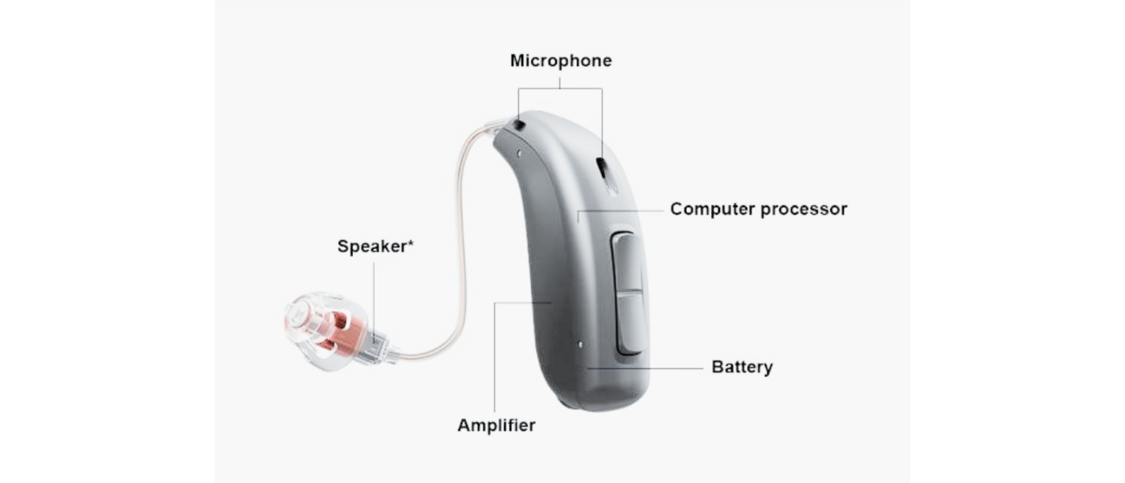 Illustration showing the 4 main parts of a hearing aid: microphone, amplifier, receiver, and battery.