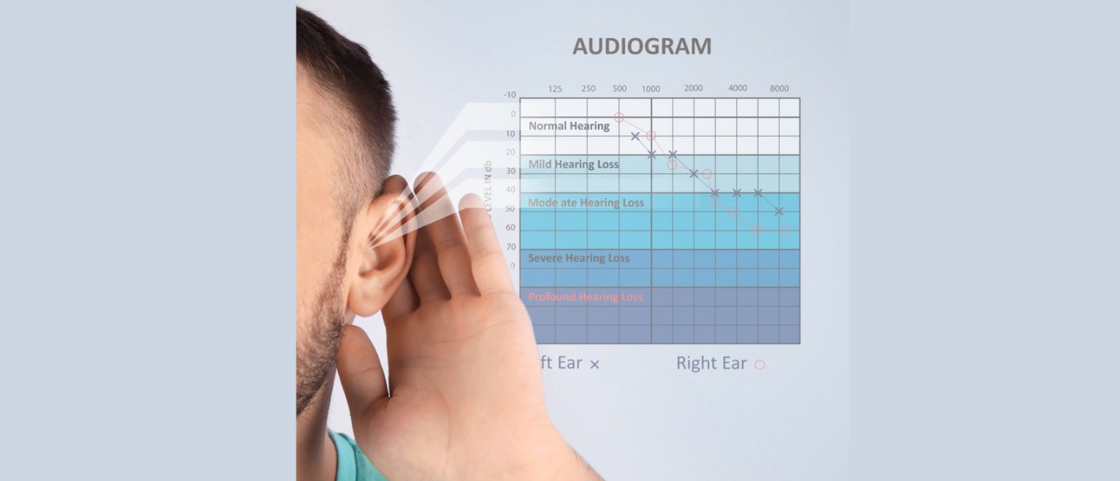Audiogram-based hearing test helps detect low-frequency conductive hearing loss – Aanvii Hearing