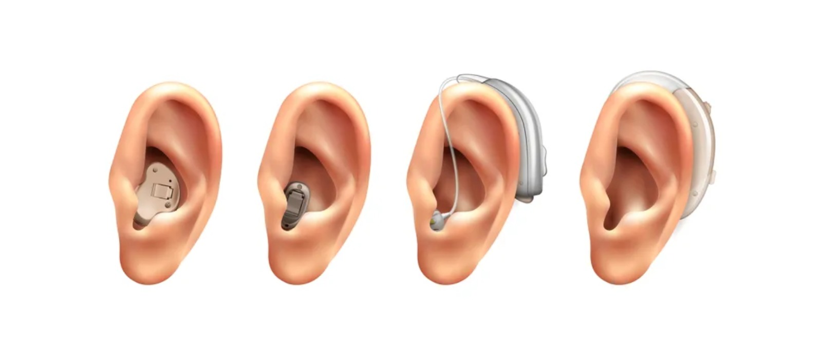 2025’s Best Hearing Aid Styles in India | Expert Picks Explore 2025's top Hearing Aid Styles in India, handpicked by professionals for all hearing needs