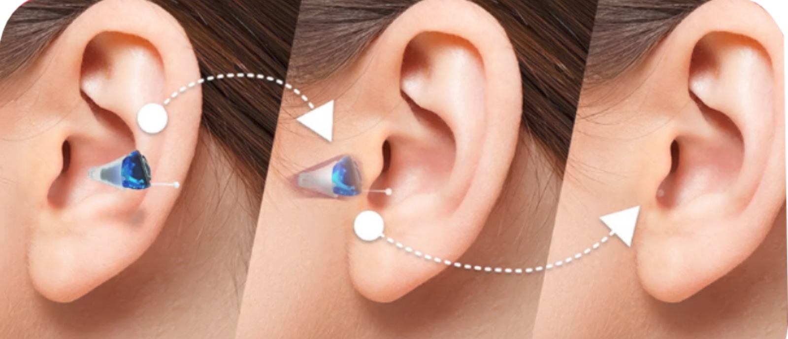 Invisible Hearing Aids for Natural Sound Clarity & Comfort | Book a Free Trial at Aanvii Hearing Discover invisible hearing aids offering natural sound clarity and comfort. Try them free at Aanvii Hearing.